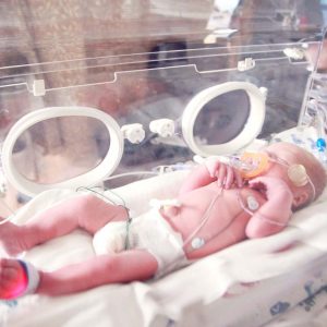 Premature infant in NICU (newborn intensive care unit)